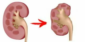 Эти 10 привычек беспощадно убивают почки, но многие из нас делают их каждый день! Поразительные открытия! почки